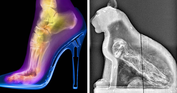 16 alkalom, mikor a röntgensugarak olyan titkokat fedtek fel, melyek eddig rejtve voltak a szemünk elől