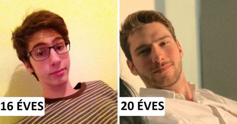 20 ember, akikkel csodát művelt a pubertás korszak