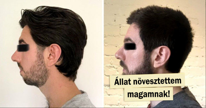 15 kép, mely igazolja, hogy a szakáll jobban megváltoztatja a férfi kinézetét, mint a plasztikai műtét