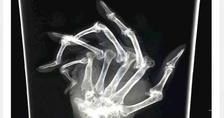 A 24 legfurcsább röntgenképek, amiket életedben láttál