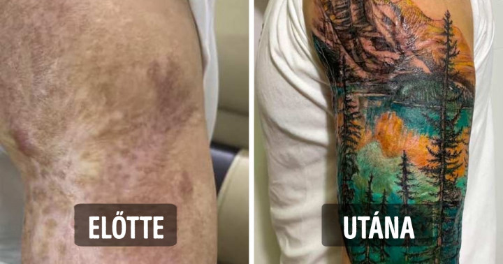 20 tetoválás, amely a hegekből és sérülésekből lélegzetelállító műalkotásokat csinált