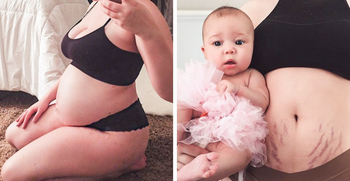 15 terhesség előtti és utáni kép, ami bemutatja a születés csodáját