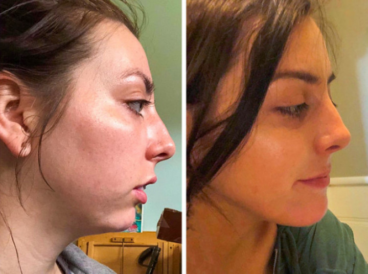 16 személy, akik plasztikai sebészre bízták magukat, és határozottan jól döntöttek