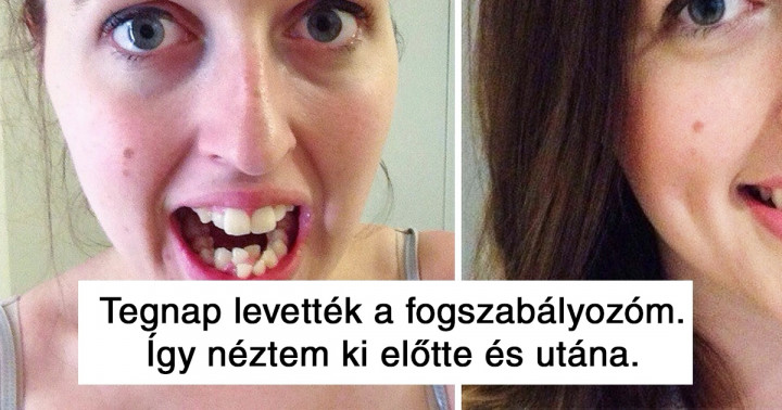 Az internetezők megmutatták, miként változott a megjelenésük, miután egyvalamit kijavítottak magukon