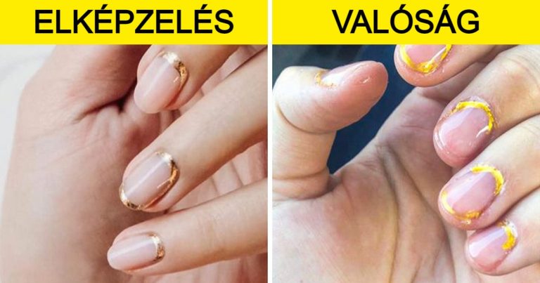 15 ember, akinek poszttraumás stressz szindrómája van, miután meglátogatott egy szépségszalont