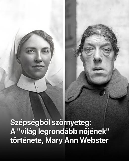 Szépségből szörnyeteg: A „világ legrondább nőjének” története